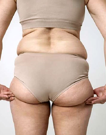 medicina estetica clinica renacer